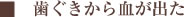 歯ぐきから血が出た